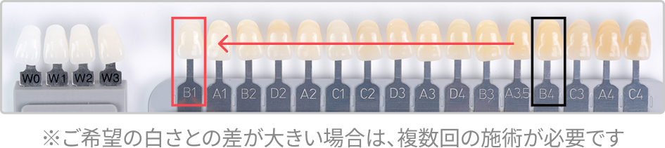 カウンセリング / プラン選び