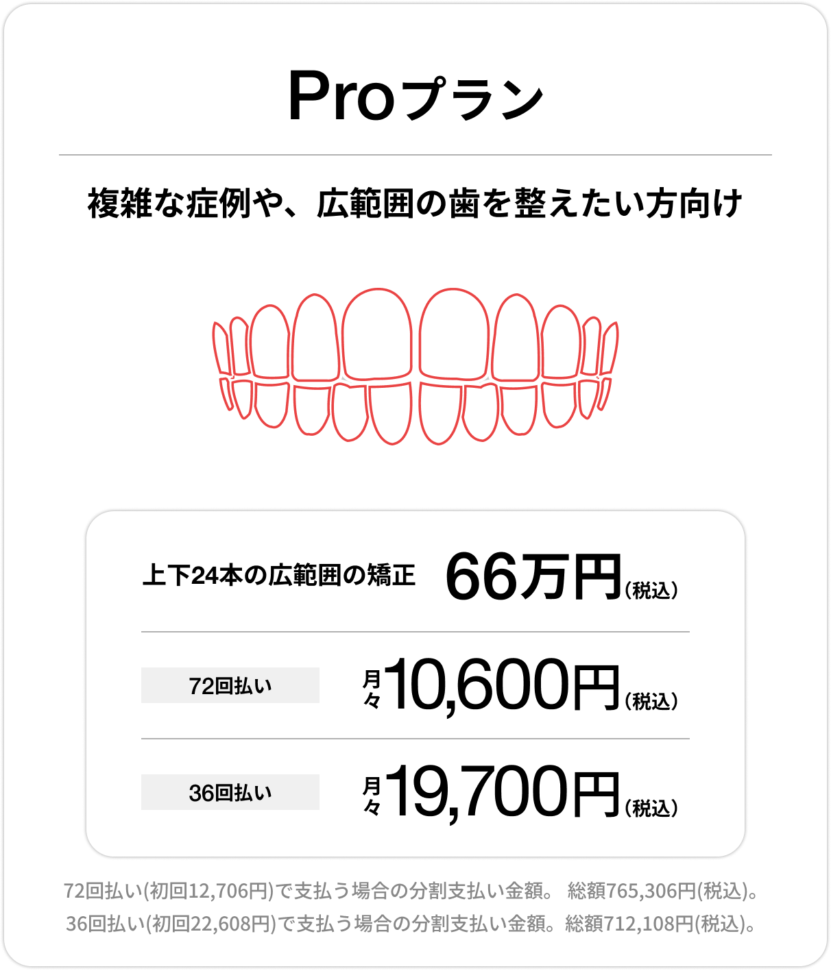 Proプラン、上下前歯24本の部分矯正66万円(税込)、72回払い 月々10,600円(税込)、36回払い 月々19,700円(税込)