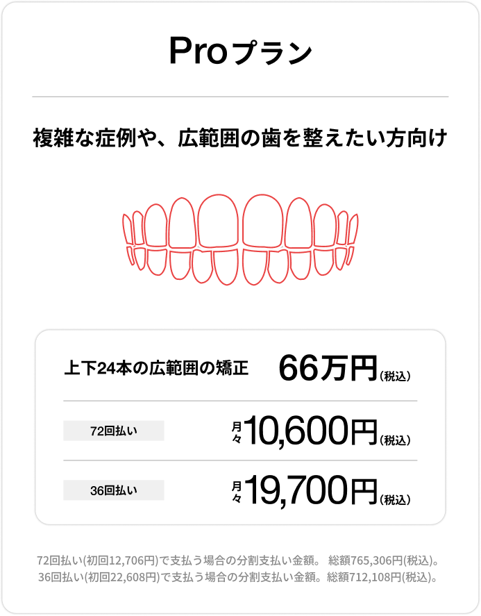 Proプラン、上下前歯24本の部分矯正66万円(税込)、72回払い 月々10,600円(税込)、36回払い 月々19,700円(税込)